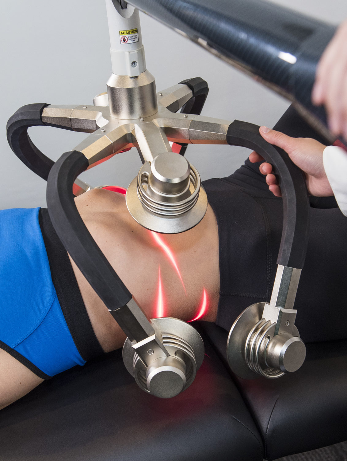 Zerona | Synergy Massage & Personal Fitness